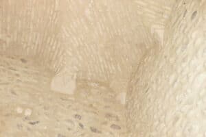 Plafond avec culs de lampe